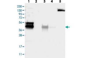Western blot analysis of Lane 1: RT-4, Lane 2: U-251 MG, Lane 3: Human Plasma, Lane 4: Liver, Lane 5: Tonsil with WDR31 polyclonal antibody  at 1:250-1:500 dilution.