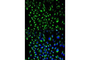 Immunofluorescence analysis of HeLa cells using LCP2 antibody (ABIN6292589). (LCP2 Antikörper)