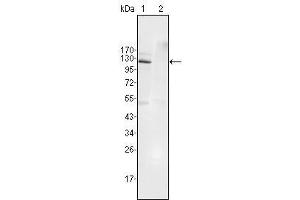 Western Blot showing EphB4 antibody used against Jurkat (1) and HEK293 (2) cell lysate. (EPH Receptor B4 Antikörper  (AA 562-612))