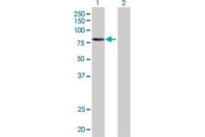 Western Blotting (WB) image for KEL 293T Cell Transient Overexpression Lysate(Denatured) (ABIN1332420)