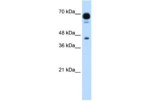 PUS7 antibody used at 1. (PUS7 Antikörper)