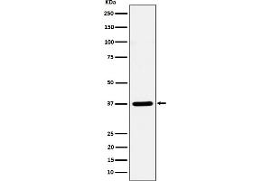 Western blot analysis of Syntaxin 16 expression in HeLa cell lysate. (Rekombinanter Syntaxin 16 Antikörper)