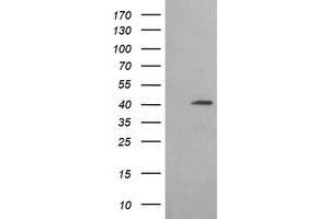 Western Blotting (WB) image for anti-Acetyl-CoA Acyltransferase 2 (ACAA2) antibody (ABIN1495727) (ACAA2 Antikörper)