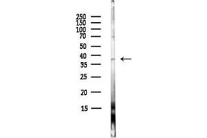 anti-Apoptotic Peptidase Activating Factor 1 (APAF1) (C-Term) antibody