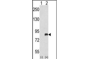 Western blot analysis of ADRBK2 (arrow) using rabbit polyclonal ADRBK2 Antibody (N-term) (ABIN653036 and ABIN2842650).