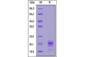 Rabbit IL-5, His Tag on  under reducing (R) condition. (IL-5 Protein (AA 20-134) (His tag))