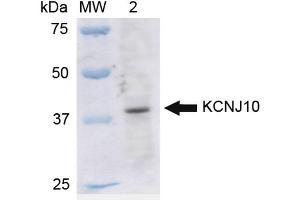 Western blot analysis of Rat Liver cell lysates showing detection of ~42. (KCNJ10 Antikörper  (Atto 594))