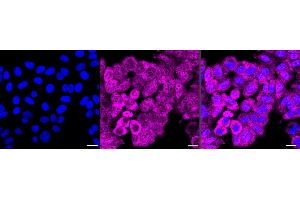 Immunocytochemical staining of HepG2 cells with GEMIN2 antibody (ABIN7798703), 1:1,000). (Rekombinanter SIP1 Antikörper)