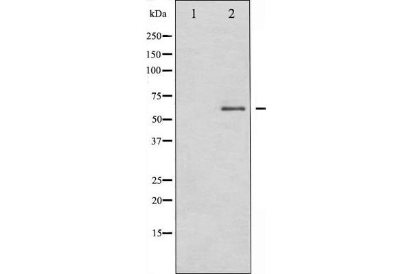 DPYSL2 Antikörper  (C-Term)