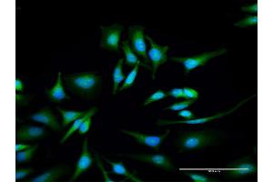 Immunofluorescence of purified MaxPab antibody to ULK4 on HeLa cell.