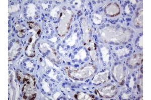 Image no. 1 for anti-Melanoma Antigen Family A, 3 (MAGEA3) antibody (ABIN1499253)