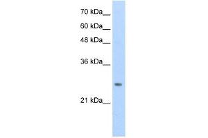 WB Suggested Anti-HOXB7 Antibody Titration:  0. (HOXB7 Antikörper  (C-Term))