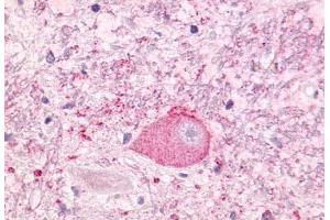 Anti-NTSR1 antibody  ABIN1049155 IHC staining of human brain, neurons and glia. (NTSR1 Antikörper  (Cytoplasmic Domain))
