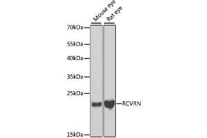Western blot analysis of extracts of various cell lines, using RCVRN antibody.