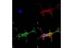 Immunocytochemistry/Immunofluorescence analysis using Mouse Anti-Notch1 Monoclonal Antibody, Clone S253-32 (ABIN2483200). (Notch1 Antikörper  (AA 20-216) (FITC))