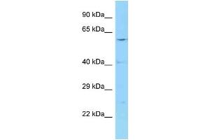WB Suggested Anti-CCT2 Antibody Titration: 1. (CCT2 Antikörper  (Middle Region))