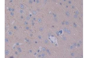 Detection of STAM1 in Rat Cerebrum Tissue using Polyclonal Antibody to Signal Transducing Adaptor Molecule 1 (STAM1) (STAM Antikörper  (AA 199-466))