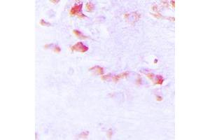 Immunohistochemical analysis of Synapsin 1 (pS9) staining in human brain formalin fixed paraffin embedded tissue section. (SYN1 Antikörper  (N-Term, pSer9))