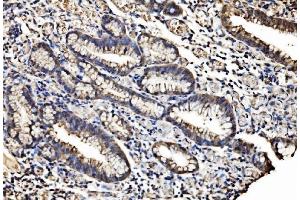 IHC analysis of Caspase-7/CASP7 using anti-Caspase-7/CASP7 antibody (ABIN7600823). (Caspase 7 Antikörper  (AA 24-303))