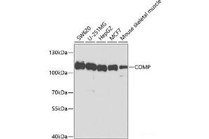 Western blot analysis of extracts of various cell lines using COMP Polyclonal Antibody at dilution of 1:1000. (COMP Antikörper)