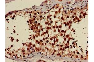 Immunohistochemistry of paraffin-embedded human testis tissue using ABIN7142682 at dilution of 1:100