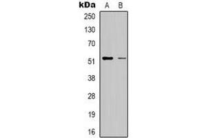 Western blot analysis of RSAD1 expression in HepG2 (A), Hela (B) whole cell lysates.
