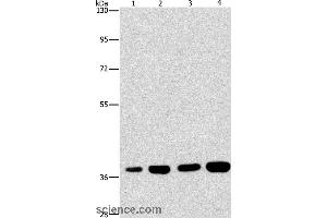 Western blot analysis of 293T and 231 cell, U937 and Raji cell, using SERPINA9 Polyclonal Antibody at dilution of 1:337. (SERPINA9 Antikörper)
