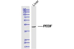 Mouse Liver lysates probed with PEDF Polyclonal Antibody, Unconjugated  at 1:300 dilution and 4˚C overnight incubation. (PEDF Antikörper  (AA 101-200))