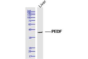 Western Blotting (WB) image for anti-serpin Peptidase Inhibitor, Clade F (Alpha-2 Antiplasmin, Pigment Epithelium Derived Factor), Member 1 (SERPINF1) (AA 101-200) antibody (ABIN5675472)