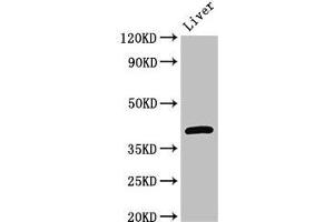 Western Blot Positive WB detected in: Mouse liver tissue All lanes: GNAT1 antibody at 3 μg/mL Secondary Goat polyclonal to rabbit IgG at 1/50000 dilution Predicted band size: 41 kDa Observed band size: 41 kDa (GNAT1 Antikörper  (AA 92-170))