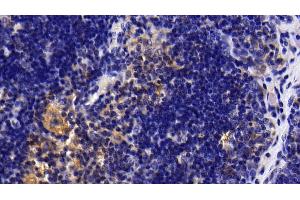 Immunohistochemistry (IHC) image for anti-Interleukin 1 Receptor, Type I (IL1R1) (AA 226-352) antibody (ABIN7438886)