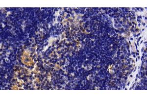 Detection of IL1R1 in Rat Thymus Tissue using Polyclonal Antibody to Interleukin 1 Receptor Type I (IL1R1) (IL1R1 Antikörper  (AA 226-352))