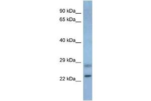 WB Suggested Anti-Neurog3 Antibody Titration: 1. (Neurogenin 3 Antikörper  (Middle Region))