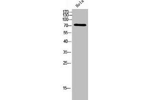 Western Blot analysis of Hela cells using ACSVL6 Polyclonal Antibody (SLC27A5 Antikörper  (Internal Region))