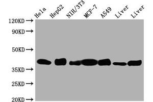 Western Blot Positive WB detected in: Hela whole cell lysate, HepG2 whole cell lysate, NIH/3T3 whole cell lysate, A549 whole cell lysate, Mouse Liver whole cell lysate, Rat Liver whole cell lysate All lanes: Aldolase antibody at 1:1000 Secondary Goat polyclonal to rabbit IgG at 1/50000 dilution Predicted band size: 40, 46 kDa Observed band size: 40 kDa (Rekombinanter ALDOA Antikörper)
