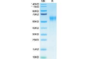 IL15RA Protein (His-Avi Tag,Biotin)