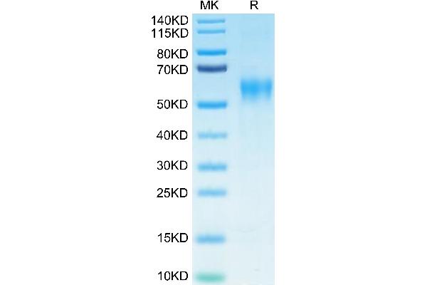 IL15RA Protein (His-Avi Tag,Biotin)