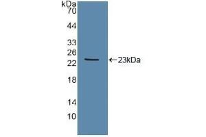Detection of Recombinant Tie2, Human using Polyclonal Antibody to TEK Tyrosine Kinase, Endothelial (Tie2) (TEK Antikörper  (AA 286-465))