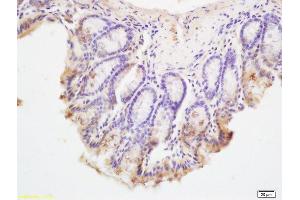 Formalin-fixed and paraffin embedded mouse intestine tissue labeled with Anti-C9orf156 Polyclonal Antibody, Unconjugated (ABIN705281) at 1:200, followed by conjugation to the secondary antibody and DAB staining