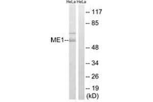 Western blot analysis of extracts from HeLa cells, using ME1 Antibody. (ME1 Antikörper  (AA 468-517))