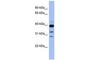 Image no. 1 for anti-Guanine Nucleotide Binding Protein (G Protein), alpha Activating Activity Polypeptide O (GNAO1) (AA 71-120) antibody (ABIN6743833) (GNAO1 Antikörper  (AA 71-120))