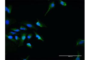 Immunofluorescence of purified MaxPab antibody to SEC13 on HeLa cell. (SEC13 Antikörper  (AA 1-325))