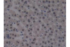 Used in DAB staining on fromalin fixed paraffin- embedded liver tissue (CUBN Antikörper  (AA 3511-3623))