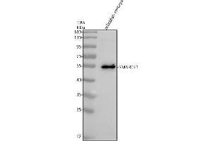 Western blot analysis of SMARCE1 using anti-SMARCE1 antibody (AZA0A8M2BB53).