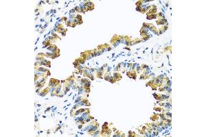 Immunohistochemistry of paraffin-embedded mouse lung using SERPINA10 antibody at dilution of 1:100 (40x lens).