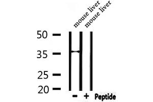 Western blot analysis of extracts from mouse liver, using SFRP3 Antibody. (FRZB Antikörper  (C-Term))