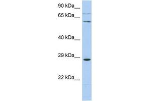 WB Suggested Anti-ZNF490 Antibody Titration:  0. (ZNF490 Antikörper  (N-Term))