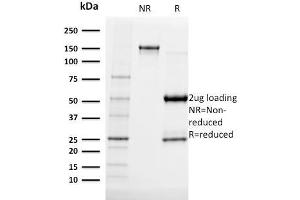 SDS-PAGE Analysis Purified Albumin Mouse Monoclonal Antibody (ALB/2141). (Albumin Antikörper)