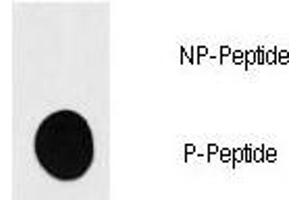 Dot blot analysis of phospho-S6K antibody. (RPS6KB1 Antikörper  (pSer418))