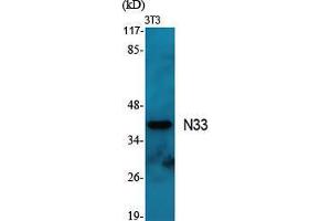 Western Blot (WB) analysis of specific cells using N33 Polyclonal Antibody. (TUSC3 Antikörper  (Internal Region))